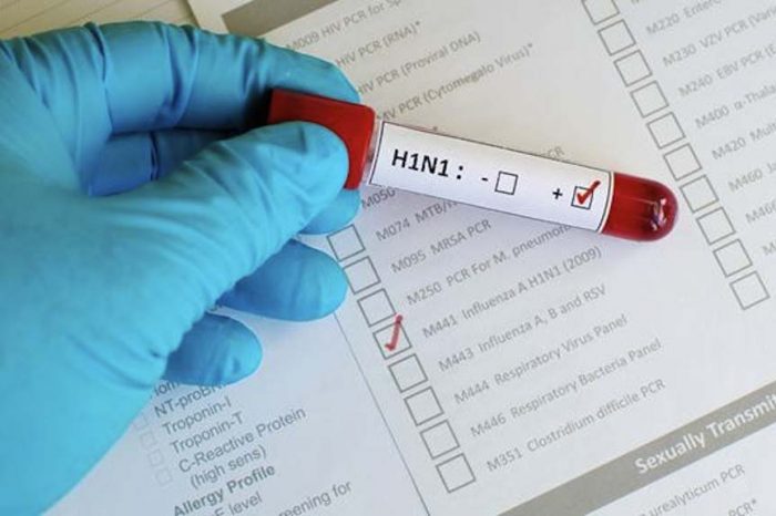 Morte por H1N1 é confirmada em Cabedelo, PB, diz Saúde